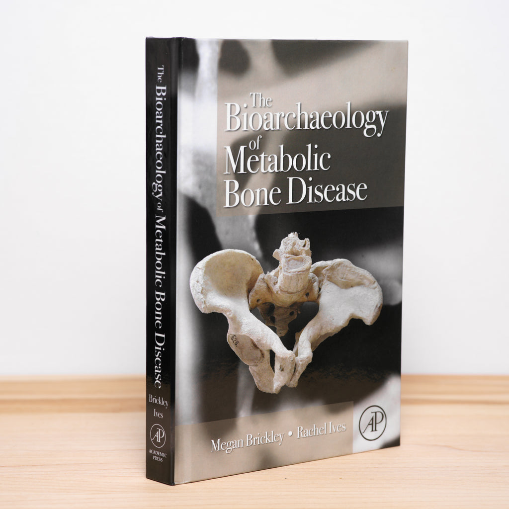 The Bioarchaeology of Metabolic Bone Disease - Brickley, Megan; Ives, Rachel